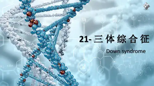 21- 三 体 综 合 征