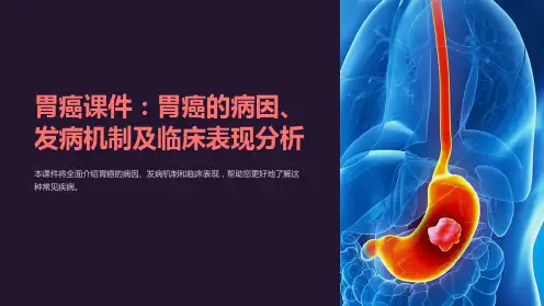 胃癌课件：胃癌的病因、发病机制及临床表现分析