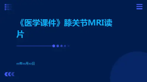 (医学课件)膝关节MRI读片