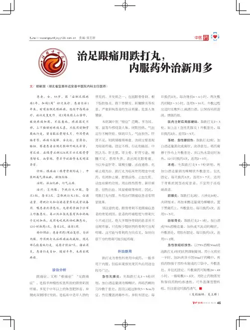 治足跟痛用跌打丸,内服药外治新用多