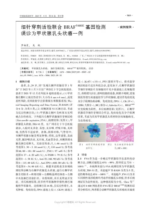细针穿刺活检联合ＢＲＡＦＶ６００Ｅ基因检测误诊为甲状腺乳头状癌一例
