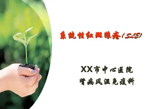 系统性红斑狼疮护理ppt课件