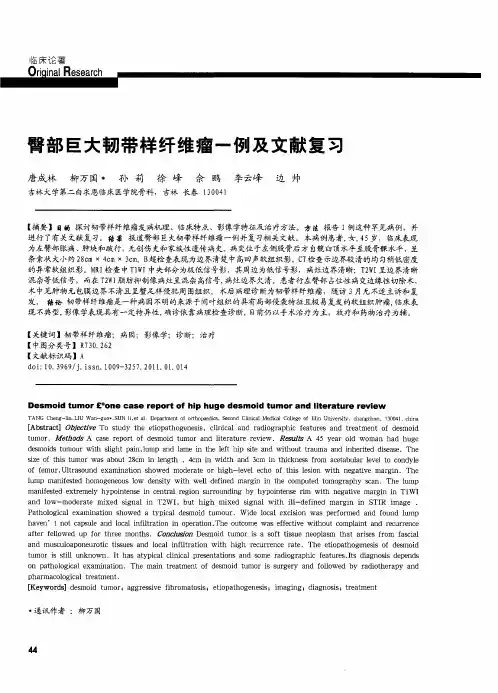 臀部巨大韧带样纤维瘤一例及文献复习