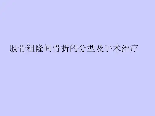 股骨粗隆间骨折的分型及手术治疗课件