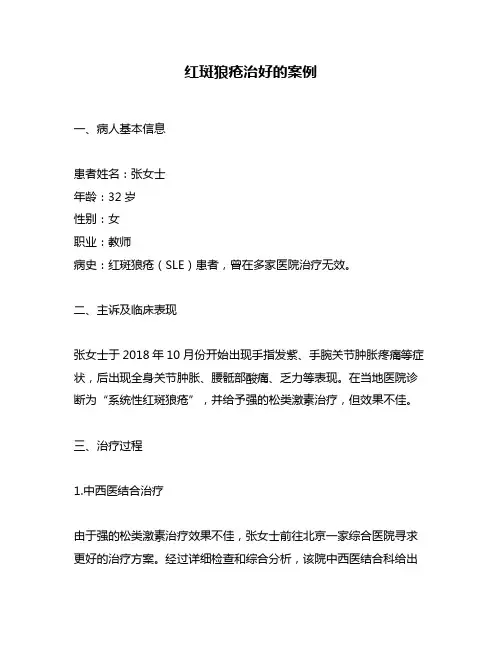红斑狼疮治好的案例