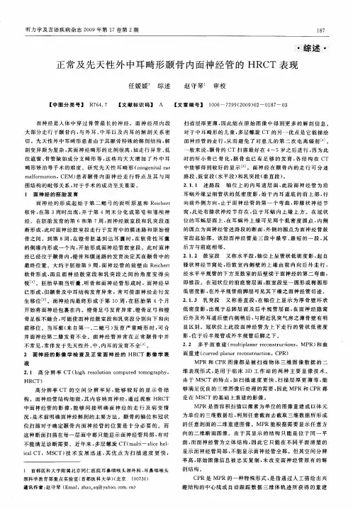正常及先天性外中耳畸形颞骨内面神经管的HRCT表现