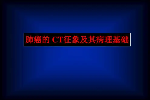 细支气管肺泡癌PPT精选课件