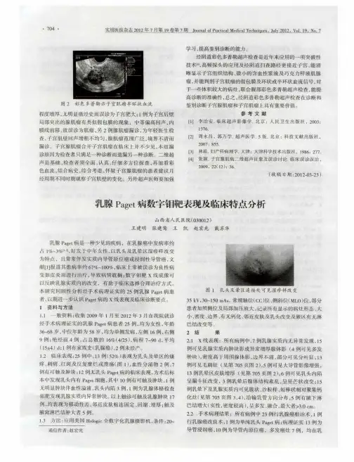 乳腺Paget病数字钼靶表现及临床特点分析
