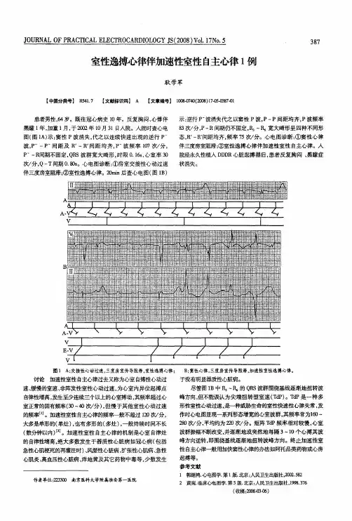 室性逸搏心律伴加速性室性自主心律1例