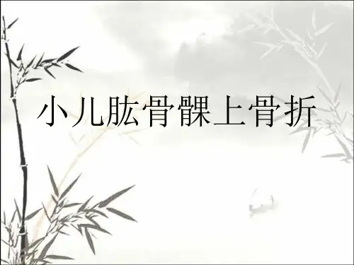 小儿肱骨髁上骨折 PPT【23页】