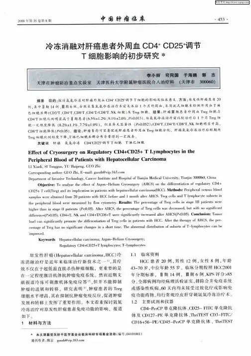冷冻消融对肝癌患者外周血CD4 +CD25 +调节T细胞影响的初步研究