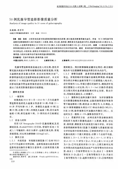 50例乳腺导管造影影像质量分析