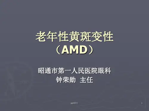 老年性黄斑变性  ppt课件