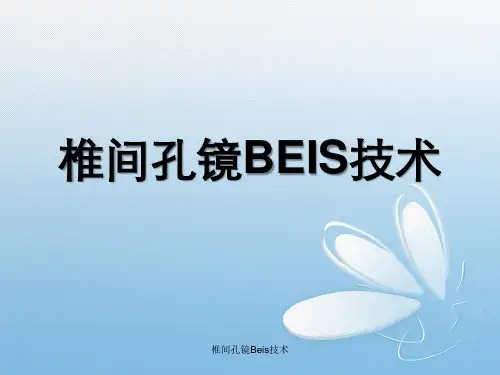 椎间孔镜Beis技术