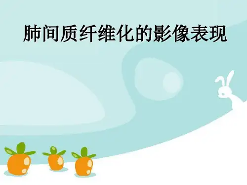 医学课件肺间质纤维化的影像表现