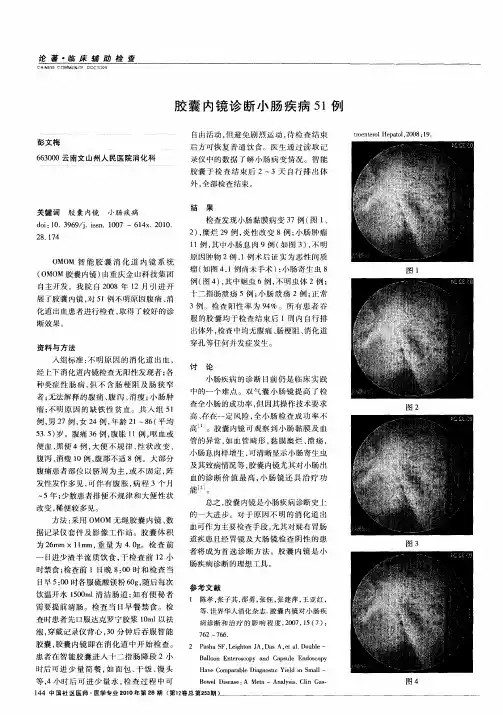胶囊内镜诊断小肠疾病51例