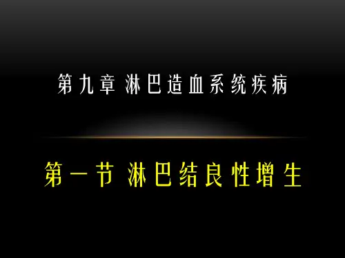 淋巴造血系统淋巴瘤ppt课件