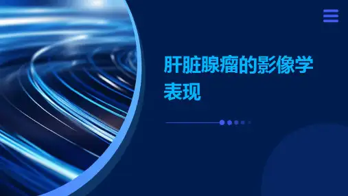 肝脏腺瘤的影像学表现修改后课件ppt