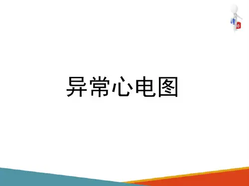 心电图检查—异常心电图(健康评估课件)