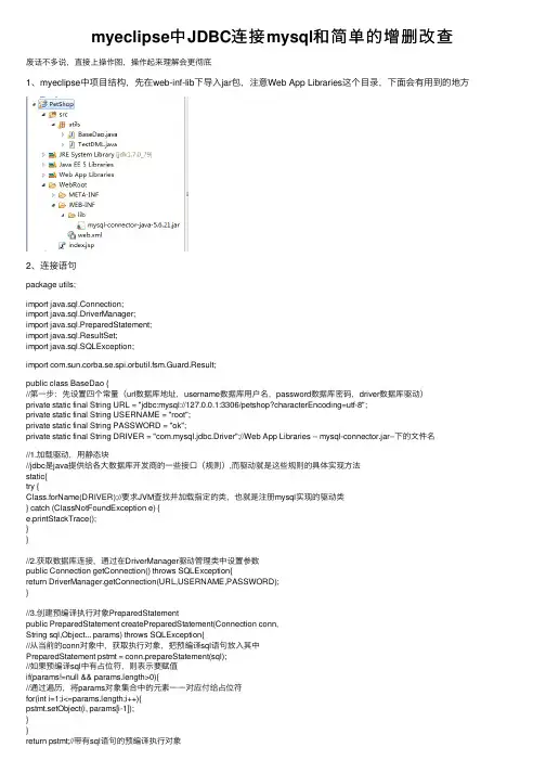 myeclipse中JDBC连接mysql和简单的增删改查