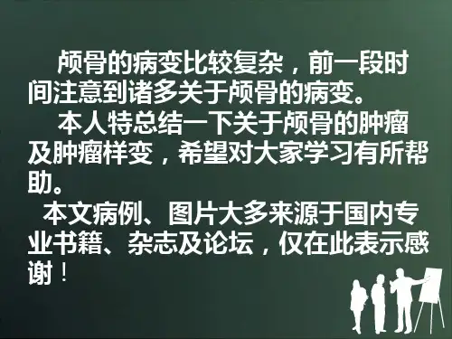 颅骨肿瘤及肿瘤样变影像ppt课件