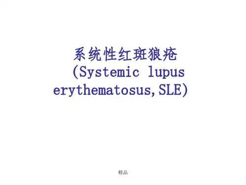 系统性红斑狼疮SL