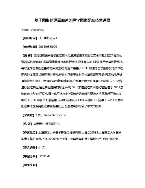 基于图形处理器加速的医学图像配准技术进展