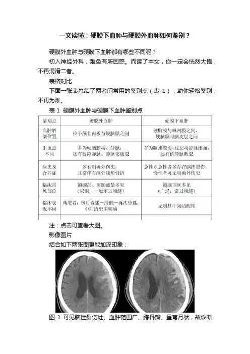 一文读懂：硬膜下血肿与硬膜外血肿如何鉴别？