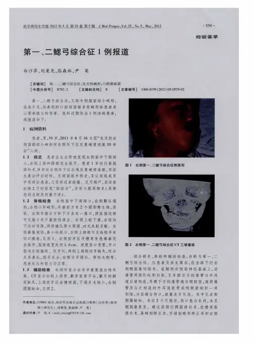 第一、二鳃弓综合征1例报道