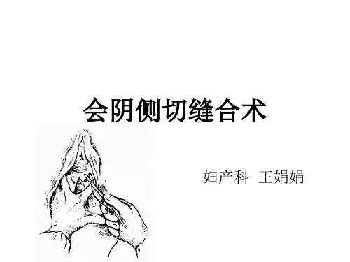 会阴侧切缝合术