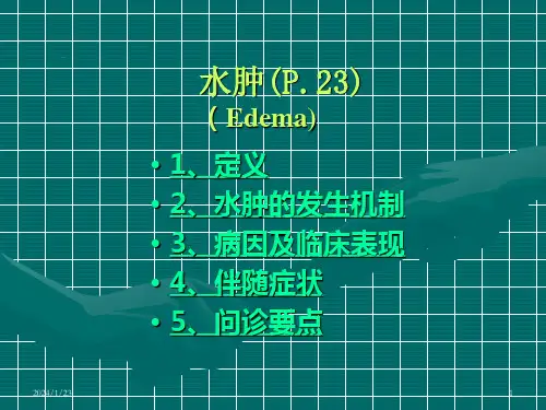 水肿PPT课件