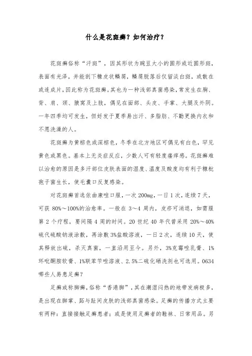 什么是花斑癣？如何治疗？