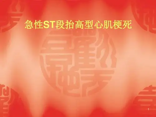急性ST段抬高型心肌梗死PPT课件
