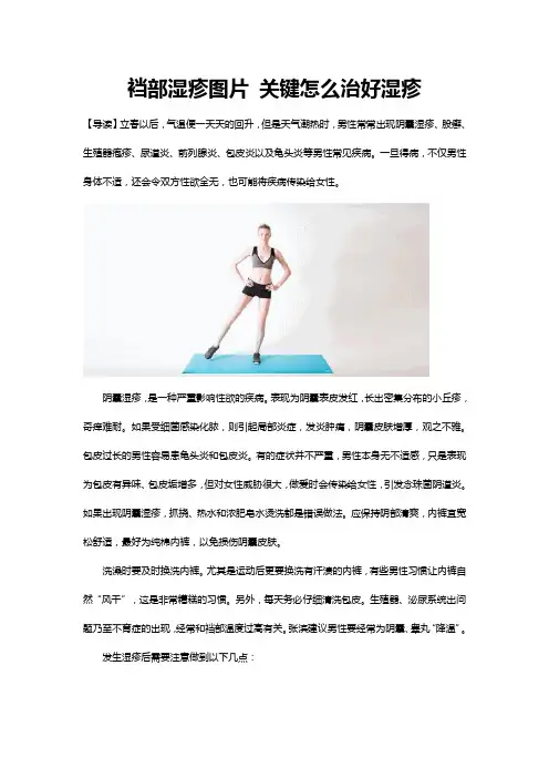 裆部湿疹图片 关键怎么治好湿疹