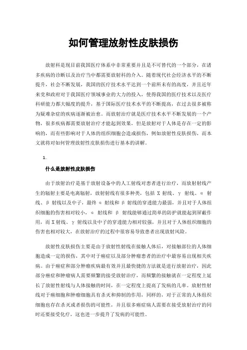 如何管理放射性皮肤损伤