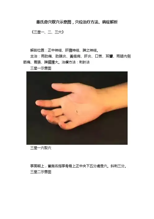董氏奇穴取穴示意图，穴位治疗方法、病症解析