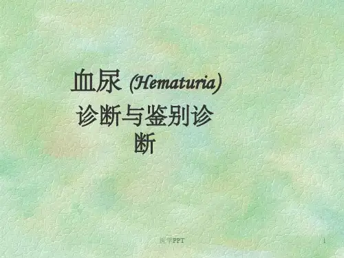《鉴别诊血尿》PPT课件