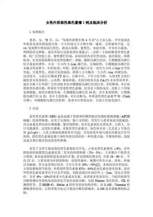 女性外阴恶性黑色素瘤1例及临床分析