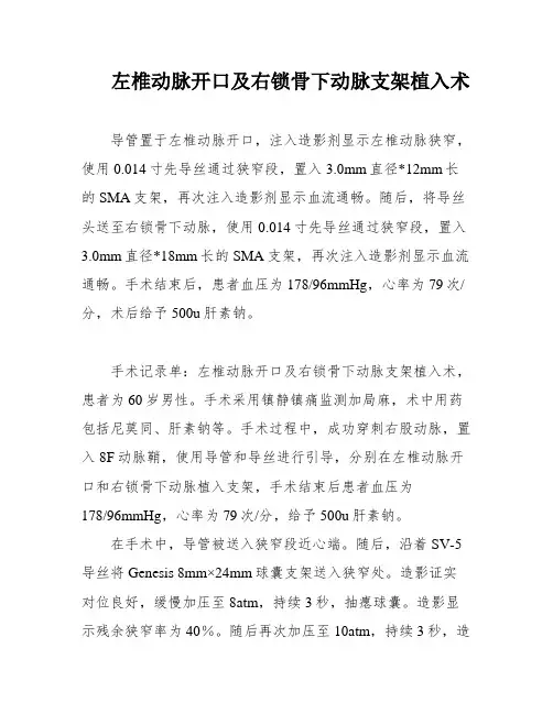 左椎动脉开口及右锁骨下动脉支架植入术