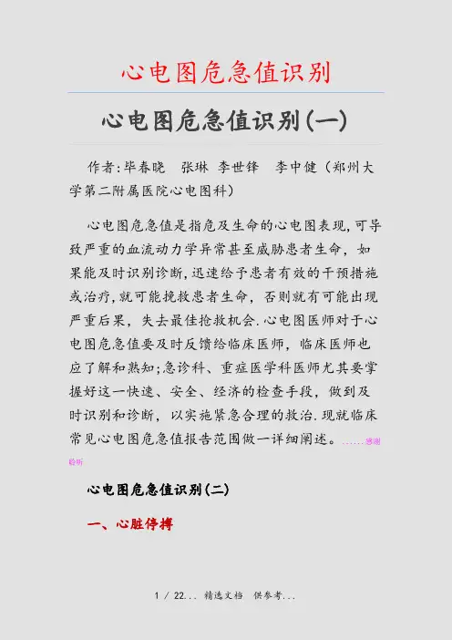 心电图危急值识别(干货)