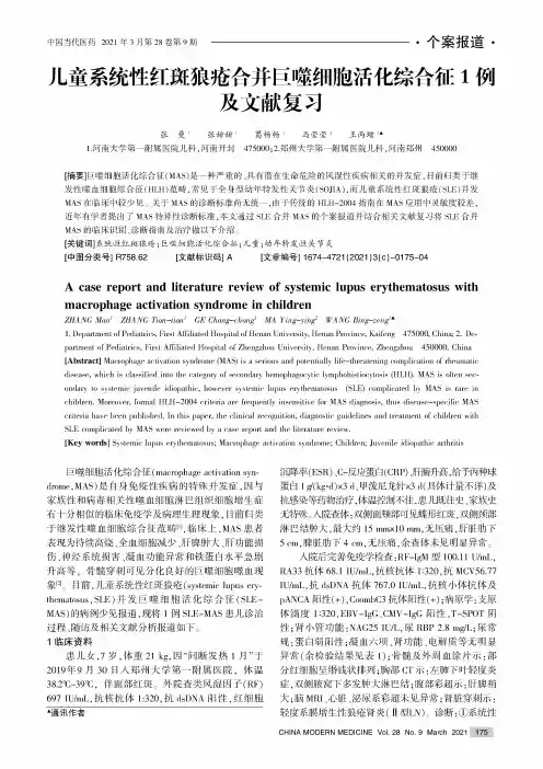 儿童系统性红斑狼疮合并巨噬细胞活化综合征1例及文献复习