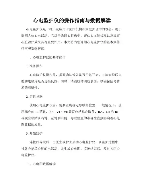 心电监护仪的操作指南与数据解读