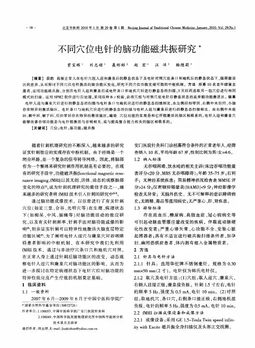 不同穴位电针的脑功能磁共振研究