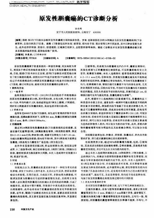 原发性胆囊癌的CT诊断分析