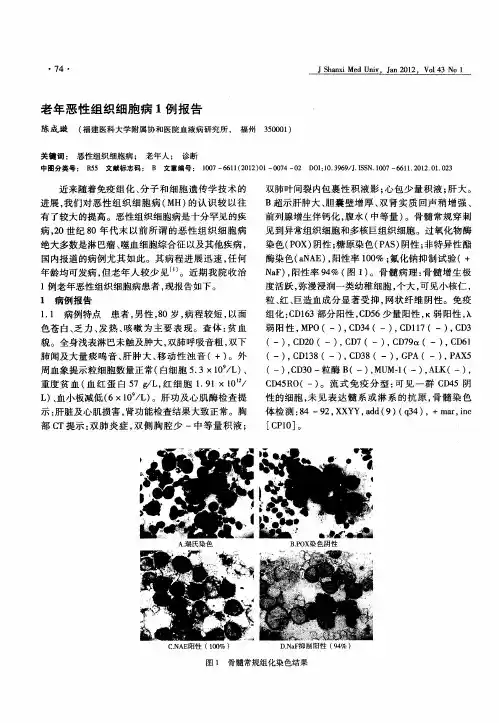 老年恶性组织细胞病1例报告