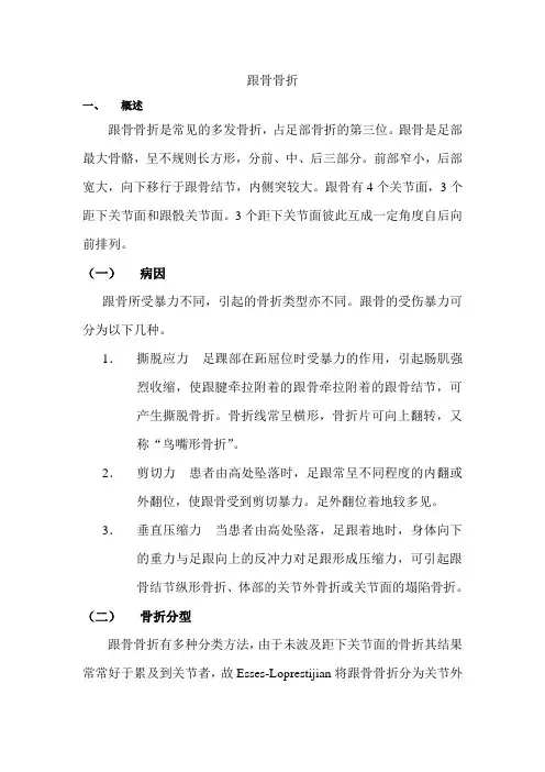 跟骨骨折
