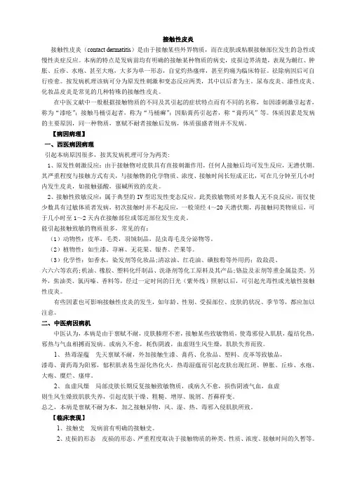 接触性皮炎