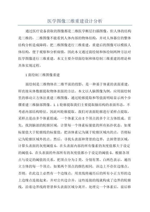 医学图像三维重建设计分析