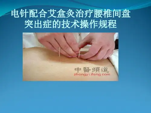 电针配合艾盒灸治疗腰椎间盘突出症技术操作规程