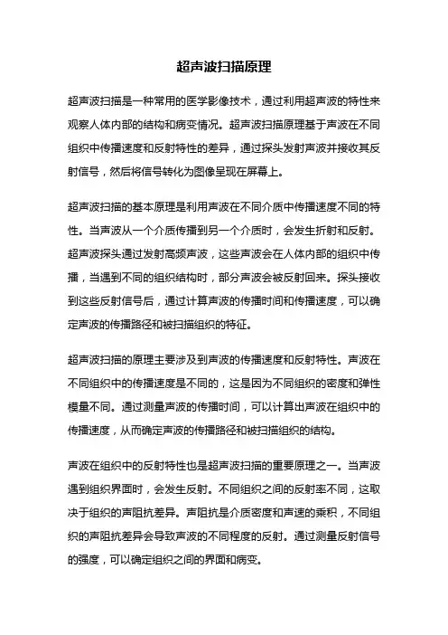 超声波扫描原理